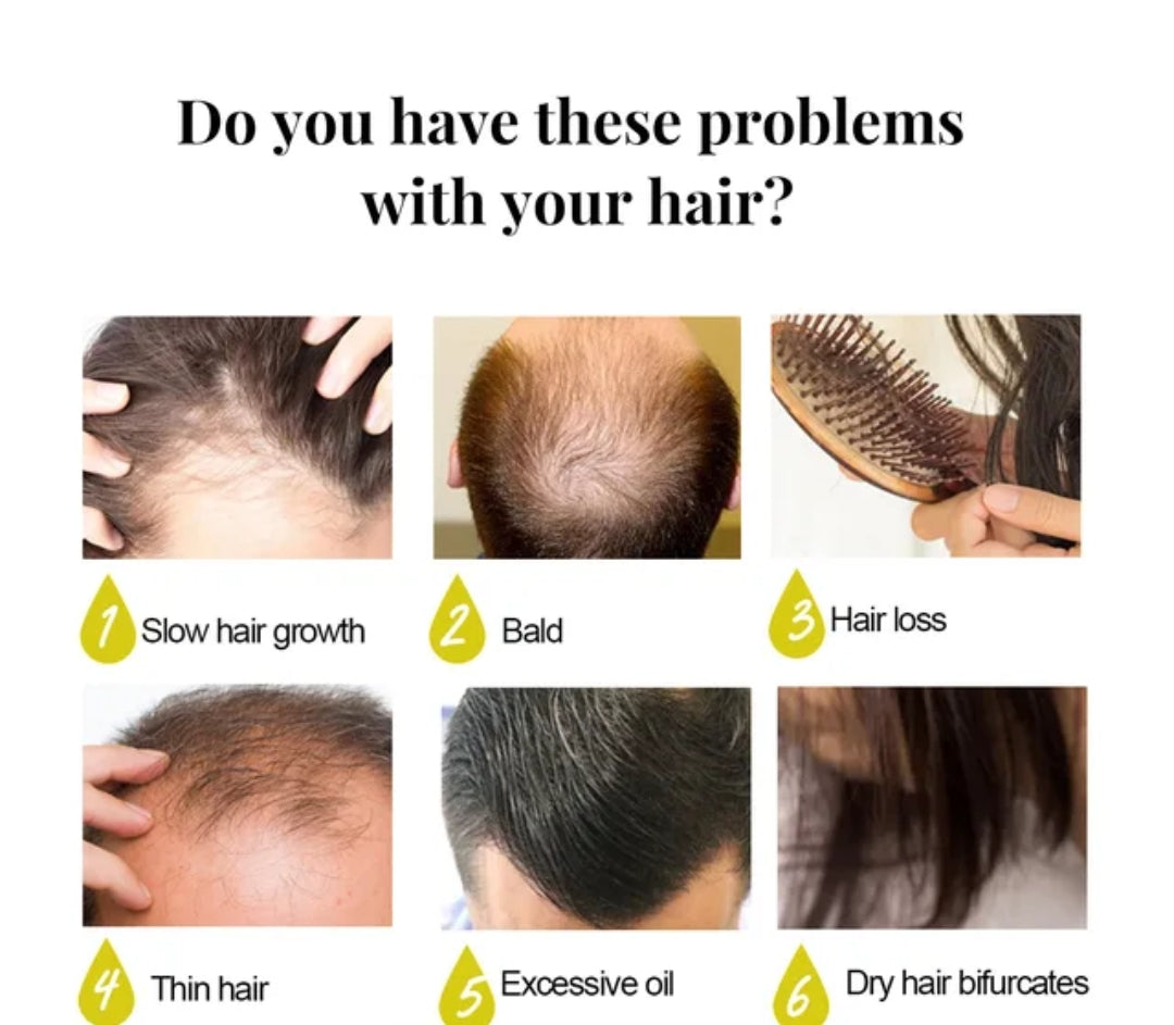 7 days ginger hair growth stimulator, anti-breakage and hair loss treatment oil organic germinal serum