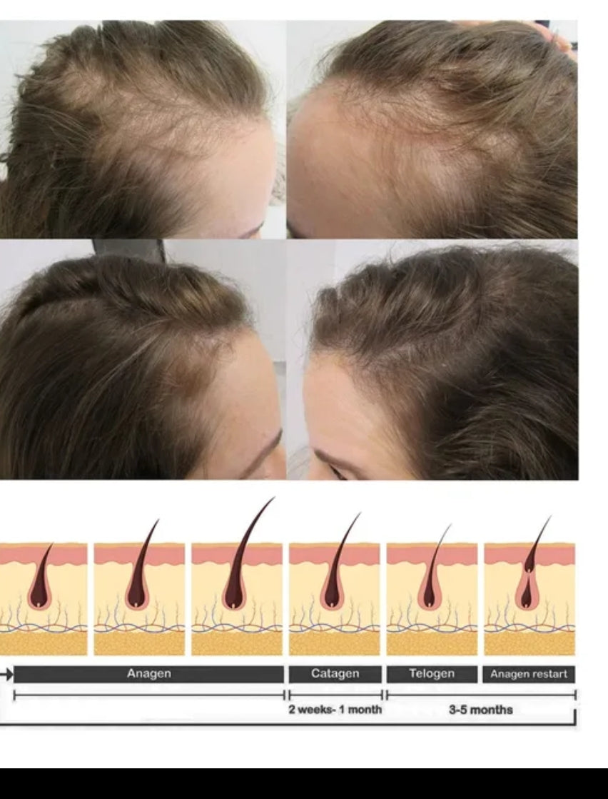 7 days ginger hair growth stimulator, anti-breakage and hair loss treatment oil organic germinal serum