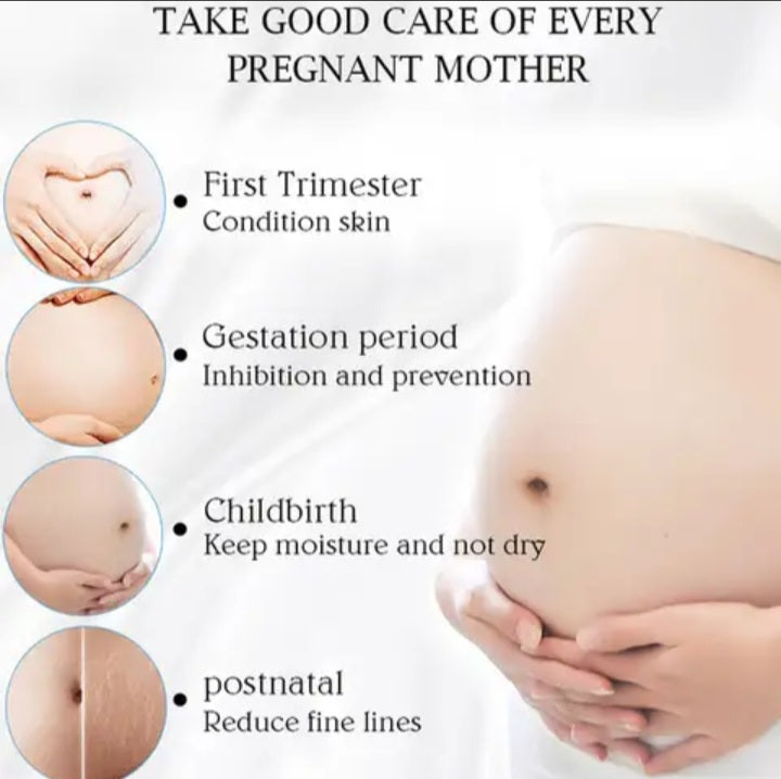 Stretch Mark remover cream,ANTI wrinkle skin repair Firming Skin Stretch Mark Removal Cream