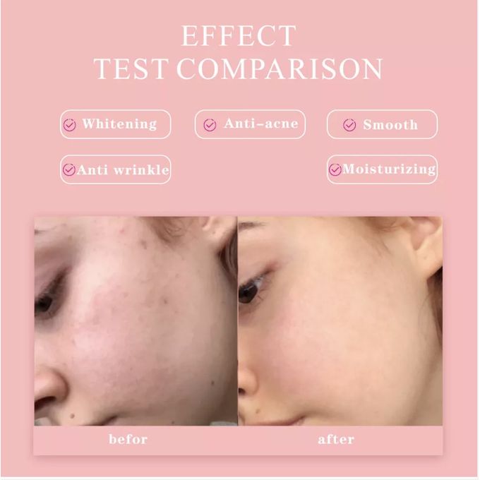 New Anti-Aging 5-in-1 Facial Serum 30% Vitamin C 5% Niacinamide 10% Herbal & Vegan Ingredients Brightening Anti-Wrinkle Anti-Age