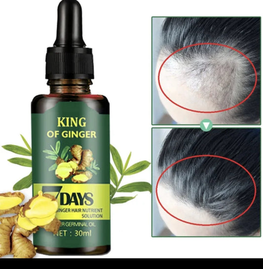 7 days ginger  hair growth stimulator, anti-breakage and  hair loss treatment oil organic germinal serum