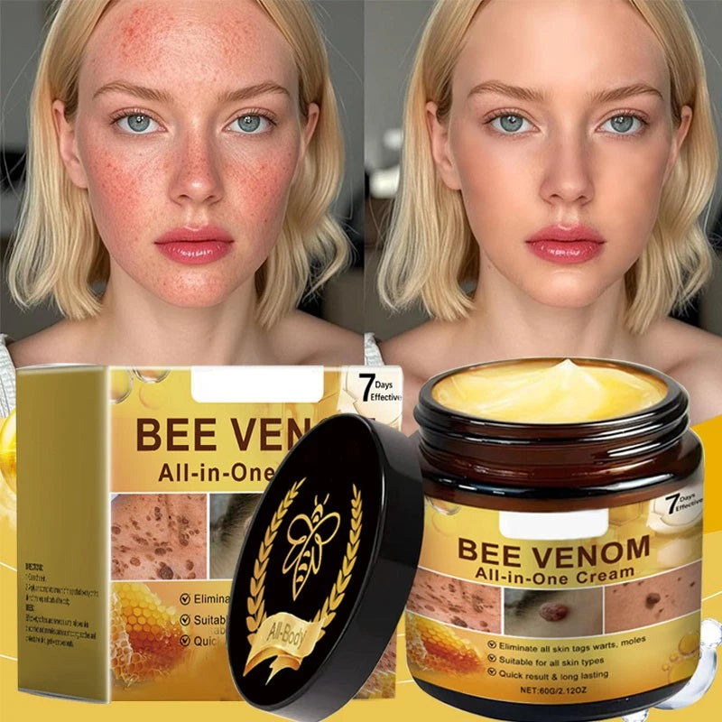 Bee Venom skin restoration cream, bee venom skin repair and therapy cream, natural bee venom skin treatment for all skin types