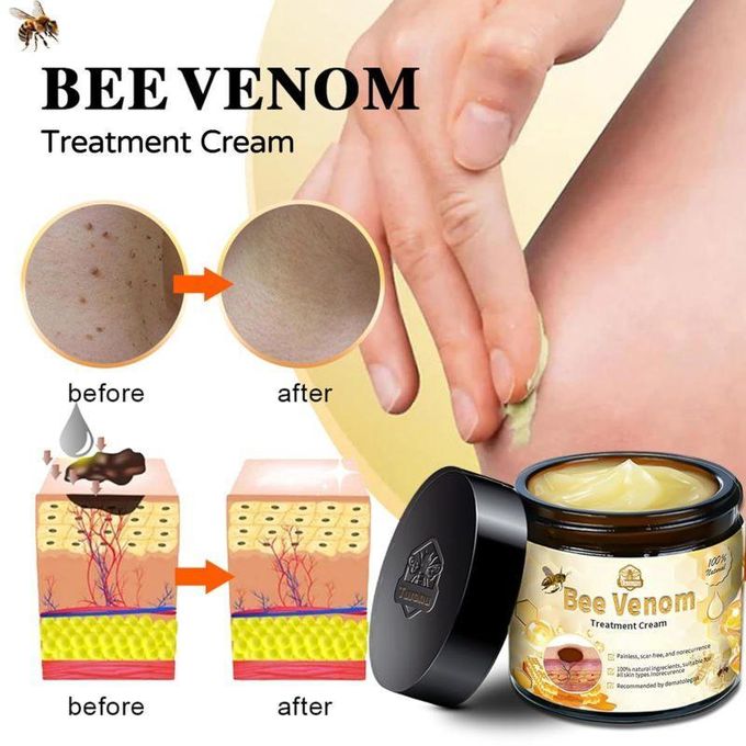 Bee Venom skin restoration cream, bee venom skin repair and therapy cream, natural bee venom skin treatment for all skin types